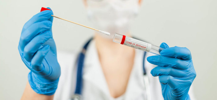 Le coût des tests virologiques ne constitue pas un frais professionnel (Ministère du travail)